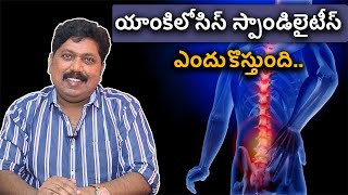 Ankylosing spondylitis problem and solution  యాంకిలోసిస్ స్పాండిలైటీస్ ఎందుకొస్తుంది [upl. by Vallo]