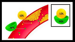 Dislipidemia resumen clínico [upl. by Einnek]