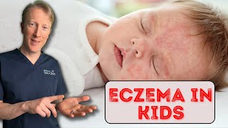 How to treat Eczema in Babies amp Children Dermatology Doctor explains [upl. by Bowden232]