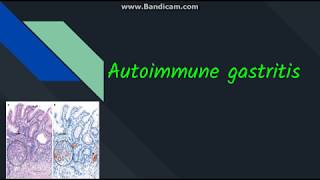 Autoimmune gastritis [upl. by Redle]