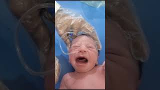 Suction From Nose Suction Must For Baby Because Entire The Bad Water In Baby Abdomen [upl. by Adnic]