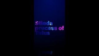 Stieda process  Ankle radiograph [upl. by Refotsirk]