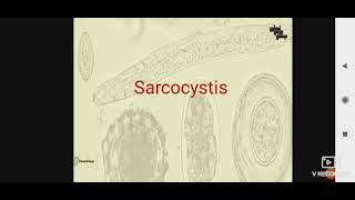 Sarcocystis para L3 [upl. by Goddart]