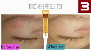 LANBENA brand Scar Removal Cream [upl. by Uile]