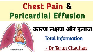 Pericardial Effusion in hindi  chest pain and pericardial effusion  seene me dard [upl. by Nikolia573]