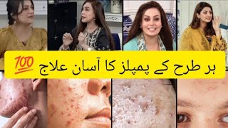 quotProven Tips to Get Rid of Pimples amp Scars Fast  Skincare Secrets by Sadia Imam amp Hibaquot [upl. by Kriste]