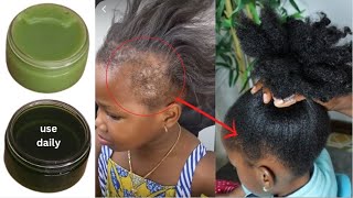 The Most Potent Hair Growth cream 😱Do Not Wash It Out Only 1 Ingredients To Grow Hair Like Crazy [upl. by Barbie]