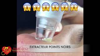 EXTRACTEUR POINTS NOIRS [upl. by Bagger587]