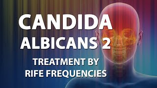 Candida Albicans 2 Candidiasis  Rife Frequencies  Energy amp Quantum Medicine  Bioresonance [upl. by Jermyn]