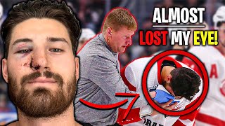 Worst Injury In My NHL Career [upl. by Leonor]