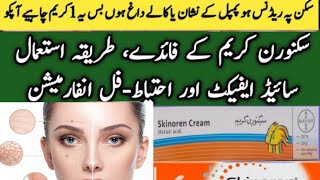 Skinoren Cream Uses and Side Effects  How To Use skinoren cream  Azelaic Acid Cream DrZaheer [upl. by Aihpled639]