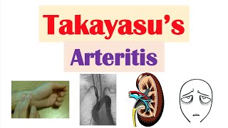 Takayasu’s Arteritis Pulseless Disease  Large Vessel Vasculitis Symptoms Diagnosis Treatment [upl. by Adnohsad127]