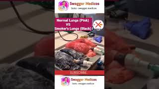 Normal Person Lungs Vs Smokers Lungs 🫁 😳 Smokingkills healthylifestyle shorts cancer smoking [upl. by Josie363]