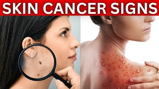 Skin Cancer Signs and Symptoms [upl. by Ikkim]