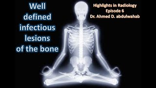 Infections lytic bone lesions Highlights in Radiology Episode 6 [upl. by Marylinda98]