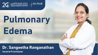 Pulmonary Edema By Dr Sangeetha Ranganathan General Practitioner [upl. by Westney487]