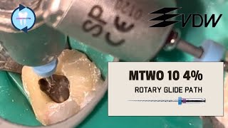 ROTARY GLIDEPATH  MTWO 1004 [upl. by Dennard]