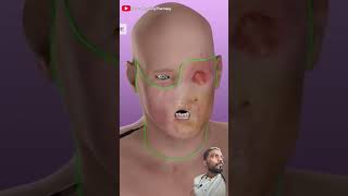 Face transplant kaise hota hai dekho  shortvideo shorts [upl. by Suivatram410]