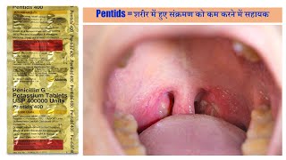 Pentids 400 Tablet Penicillin G or Benzylpenicillin बैक्टीरिया के सेल वाल को ख़तम करने वाली दवा [upl. by Mcclenon]