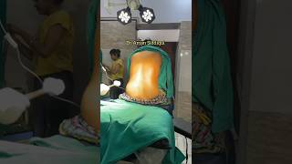 Spinal Anesthesia  How to give Spinal Anesthesia  Dr Aman Siddiqui  anaesthesia  spinal [upl. by Truc]