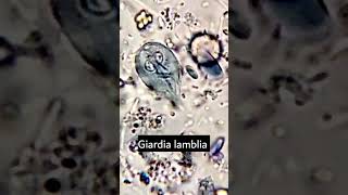 Giardia lambliaGiardiasis parasiteparasite under microscope microscopy parasitology [upl. by Lewison427]