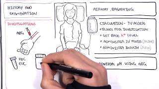 Diabetic Ketoacidosis Diabetes Type I Management Summary [upl. by Orian370]