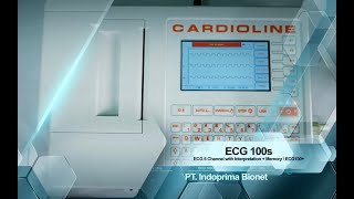 ECG 100s  CARDIOLINE [upl. by Benn]