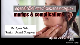 മുണ്ടിനീരു നിസാരക്കാരൻ അല്ല mumps complications and treatment [upl. by Knudson764]