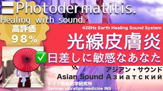 ✅光線皮膚炎 日差しに敏感なあなた〓Photodermatitis Relax amp Healing music with Dr Rife [upl. by Rozanna]