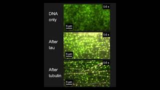 Tau microtubule binding to DNA [upl. by Ruperto]