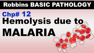 Ch12  Hemolysis due to MALARIA  Blood Pathology  Dr Asif Lectures [upl. by Yarvis]