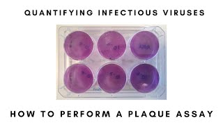 How to Perform a Plaque Assay [upl. by Thurnau954]