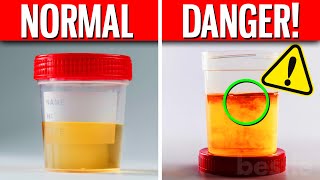 The Color Of Your Pee Says THIS About Your Health [upl. by Cha]