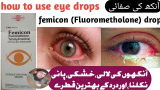 Fluorometholone eye drop uses benefits dosage and sied effect in UrduBest eye dropfemicon eye drop [upl. by Pantin]