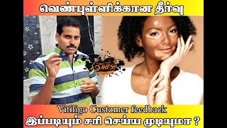 vitiligo treatment in trichy best vitiligo treatment in tamilnadu vitiligo cream vitiligo tattoo [upl. by Nnaid381]