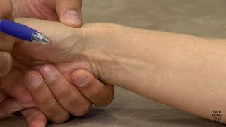 Mayo Clinic Minute Reducing thumb arthritis pain [upl. by Aicirtap90]