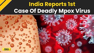 Mpox In India First Case Of Deadly Clade 1B Variant Of Mpox Virus Found In Kerala [upl. by Ormond]