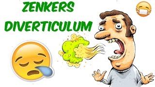 Zenkers Diverticulum SMELLY BREATH RUINING YOUR DAY [upl. by Jessie125]