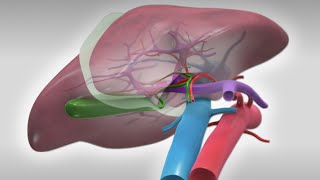 Laparoscopic right hepatectomy [upl. by Rosinski666]