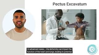 Pectus Excavatum [upl. by Nyar]