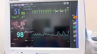 Monitoreo ECG 3 derivaciones [upl. by Ellednahc]