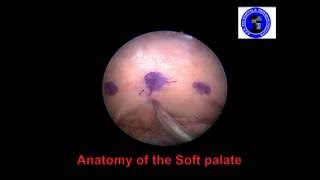 Anatomy of the Soft Palate [upl. by Sparhawk]