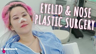 Eyelid and Nose Plastic Surgery  Xiaxues Guide To Life EP211 [upl. by Htrahddis225]