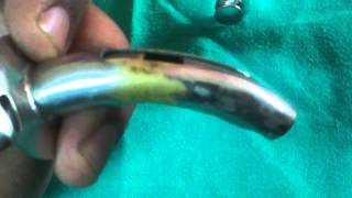 fullers bivalved metallic tracheostomy tube [upl. by Ahseenyt]