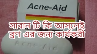 Acne aid soap bar review [upl. by Kin]