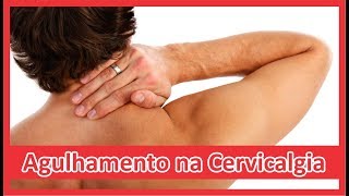 Live sobre Agulhamento na Cervicalgia  18102017 [upl. by Aihtnyc]