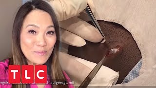 Dr Sandra Lee entfernt Zyste mit Skalpell  Dr Pimple Popper  TLC Deutschland [upl. by Ylrebmi856]