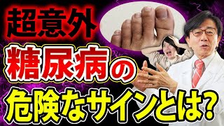 【放置厳禁】知らないと後悔する糖尿病の初期症状はコレ！絶対見逃さないで！ [upl. by Arza]