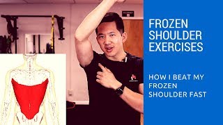 Frozen shoulder exercises  how I got relief in just two days [upl. by Magill]