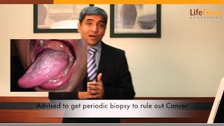 Treatment for Oral Lichen Planus Explained by Dr Rajesh Shah MD [upl. by Downe]